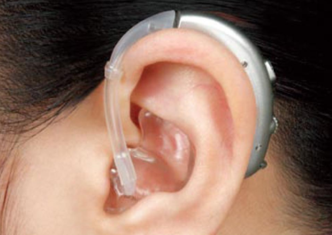 助听器质检报告标准GB/T14199，助听器检测报告